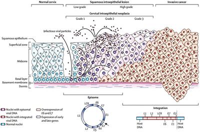 Efficacy of different medications in the treatment of gynaecological tumours: a clinical meta-analysis